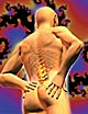 Back Pain , disc delocation