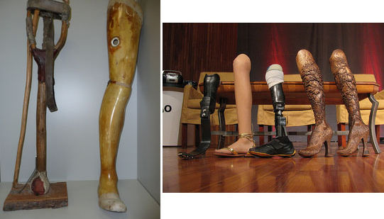 protesi, arti artificiali, gambe artificiali