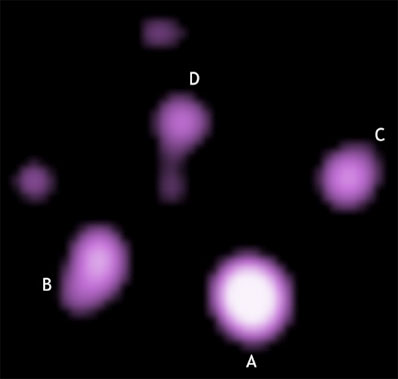 This is Chandra's X-ray view of the so-called Cloverleaf quasar, a single object whose image has been reproduced four times through an effect known as 'gravitational lensing'.