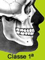 apparecchio ortodontico
