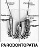 diagramma di parodontopatia