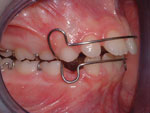 ortodonzia mobile