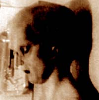 Grigio visto nel video dell'autopsia aliena di Ray Santilli