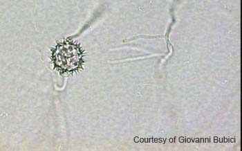 Pythium uncinulatum (11)