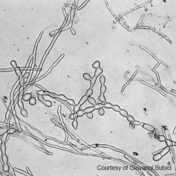 Rhizoctonia solani 01