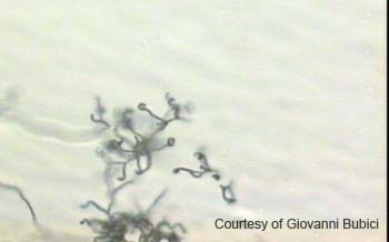 Streptomyces (15)