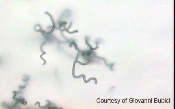 Streptomyces (16)