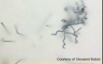 Streptomyces (17)