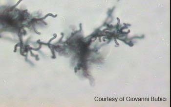 Streptomyces (20)