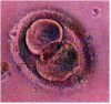 embrione a due cellule