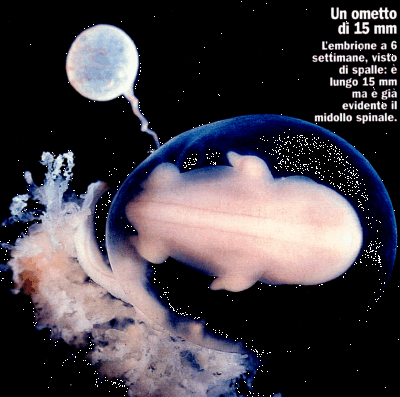 Embrione di 6 settimane