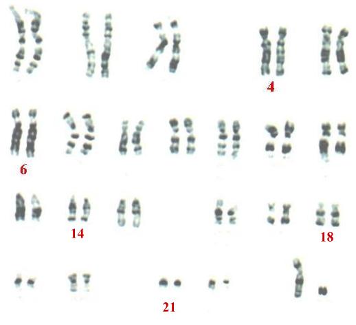 cromosomi.jpg